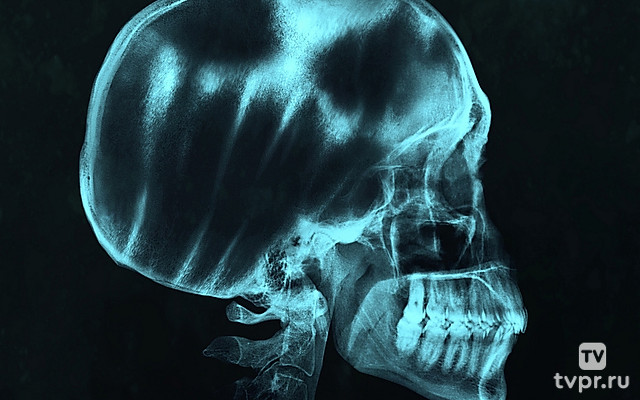 13 клиническая