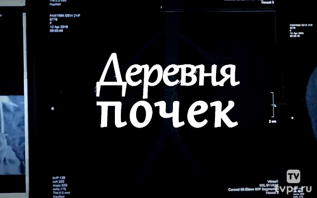 Деревня почек