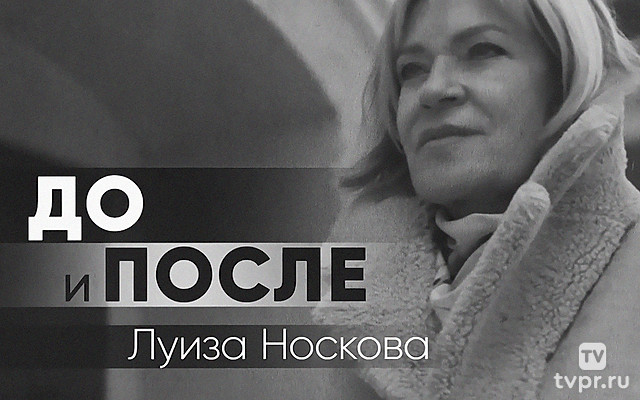 До и после. Луиза Носкова